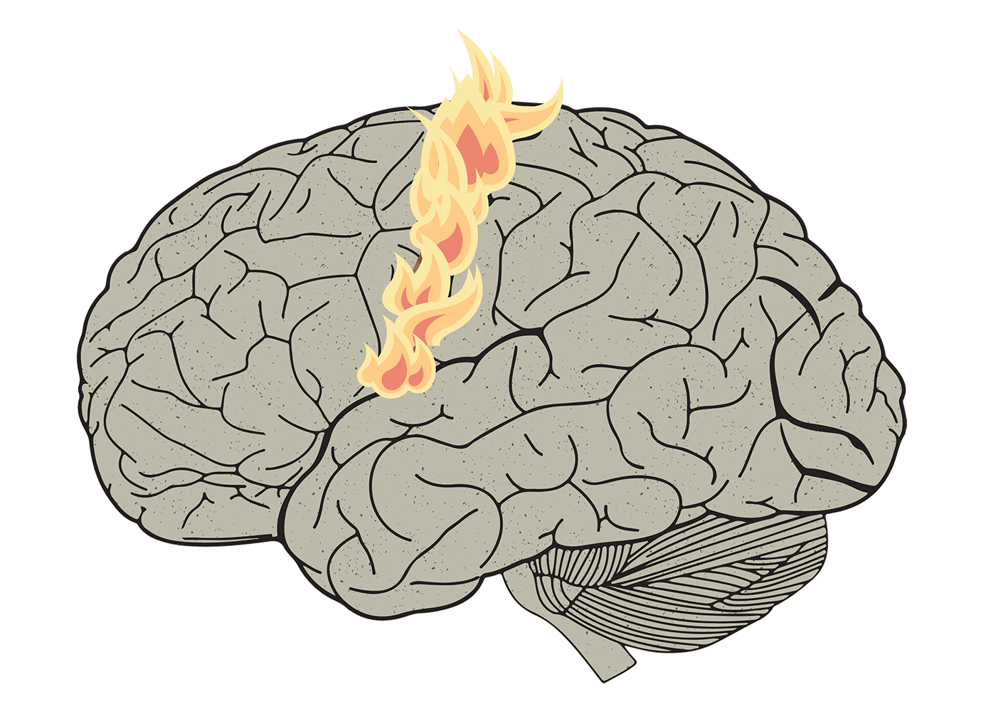 Illustrated human brain with flames burning on its surface along the primary motor cortex.
